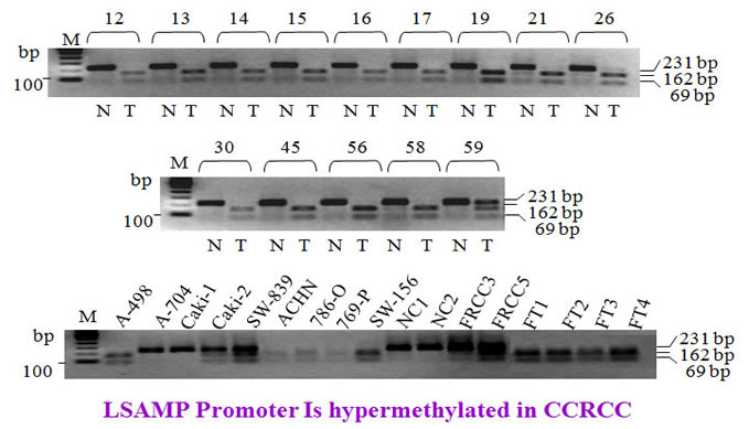 LSAMP methylation analysis